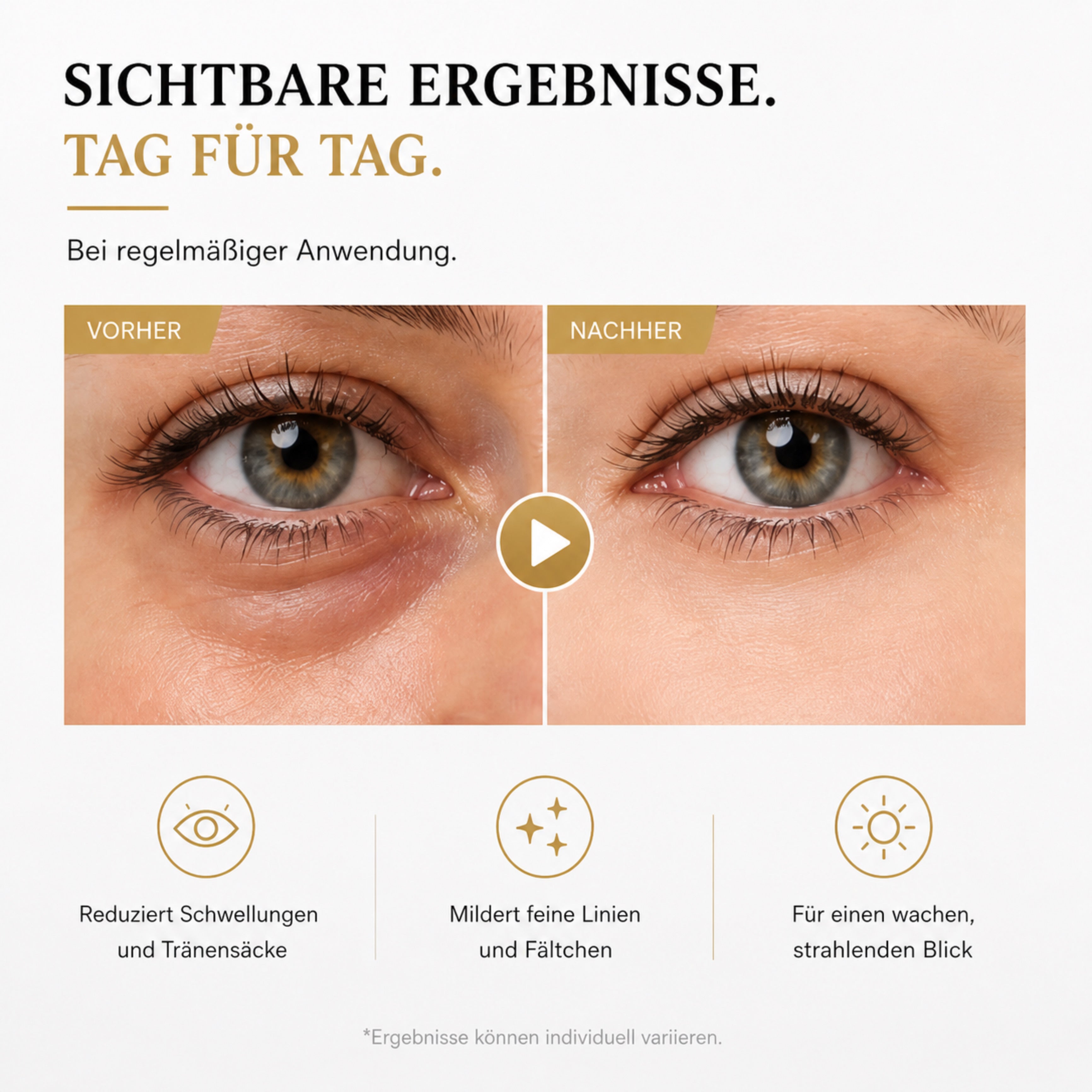 Gesichtsmassagegerät LUMIÉRA EyeLift Pro Augenmassagegerät mit Rotlicht & Mikrostrom - Lalano’S Cosmetics 