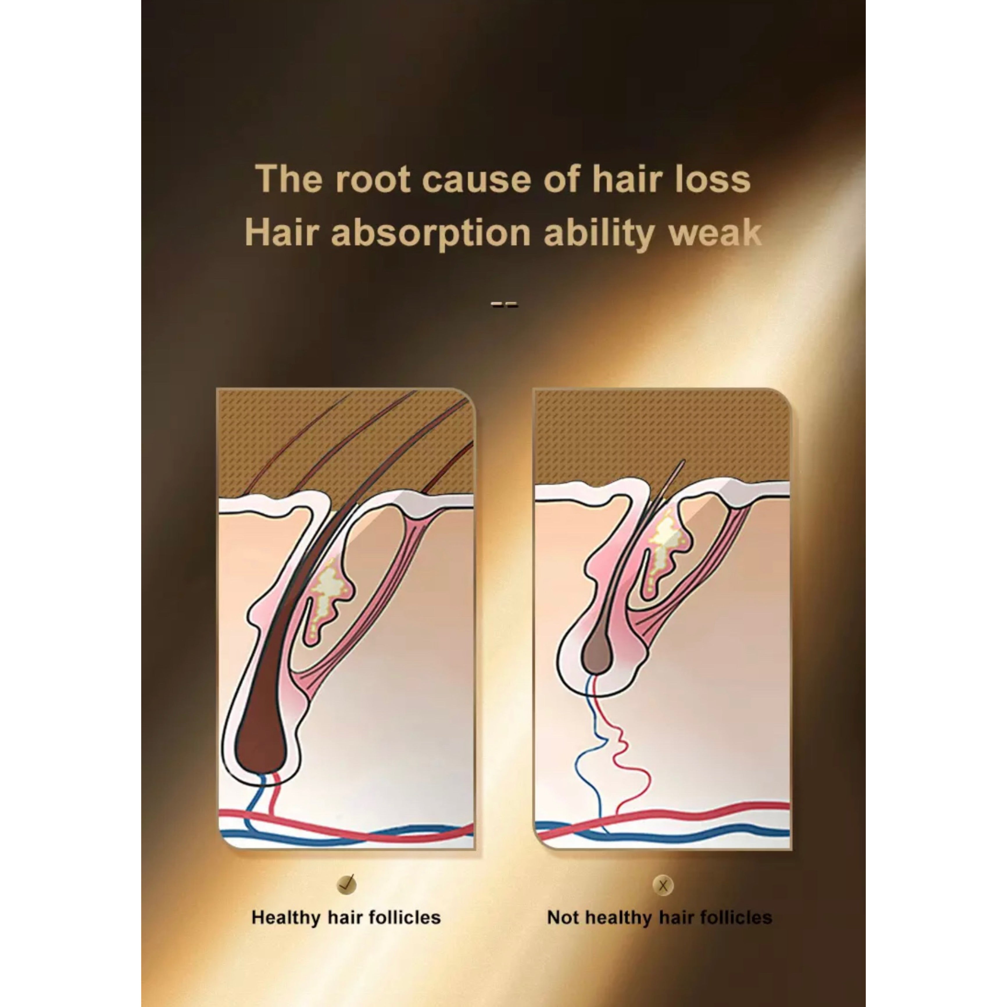 Hair PowerComb, Anti Haarausfall, LED Bürste, Haarwuchskamm - Lalano’S Cosmetics 