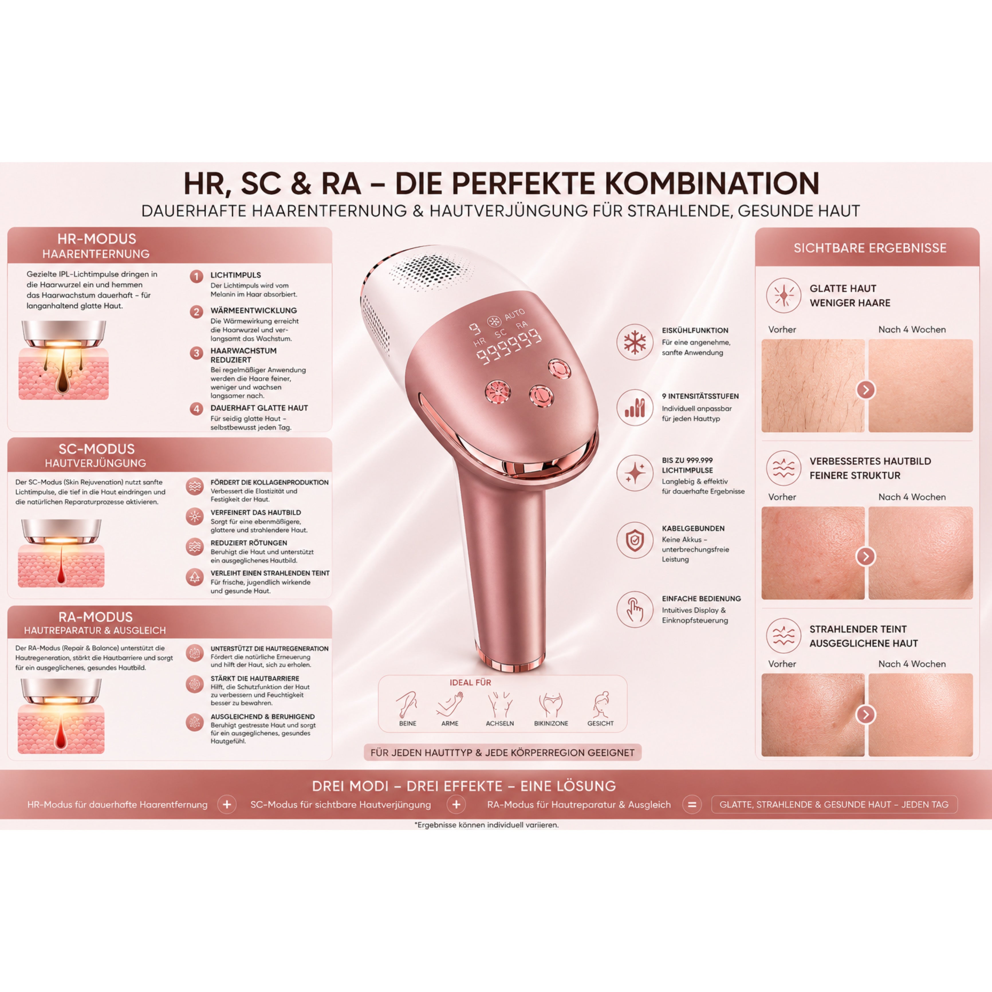IPL-Haarentferner IceSilk Pro mit Eiskühlfunktion, HR/SC/RA & Auto-Modus - Lalano’S Cosmetics 