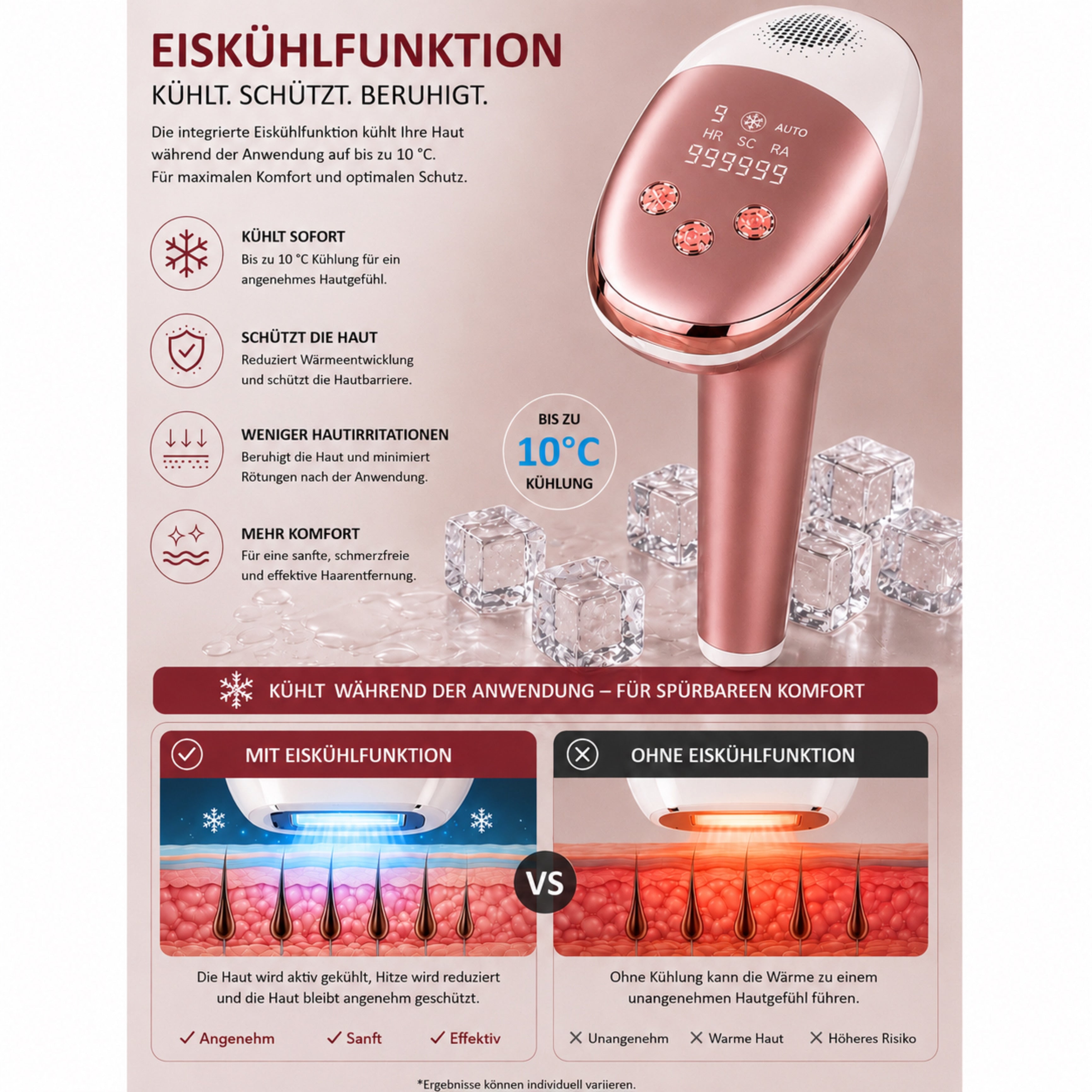 IPL-Haarentferner IceSilk Pro mit Eiskühlfunktion, HR/SC/RA & Auto-Modus - Lalano’S Cosmetics 