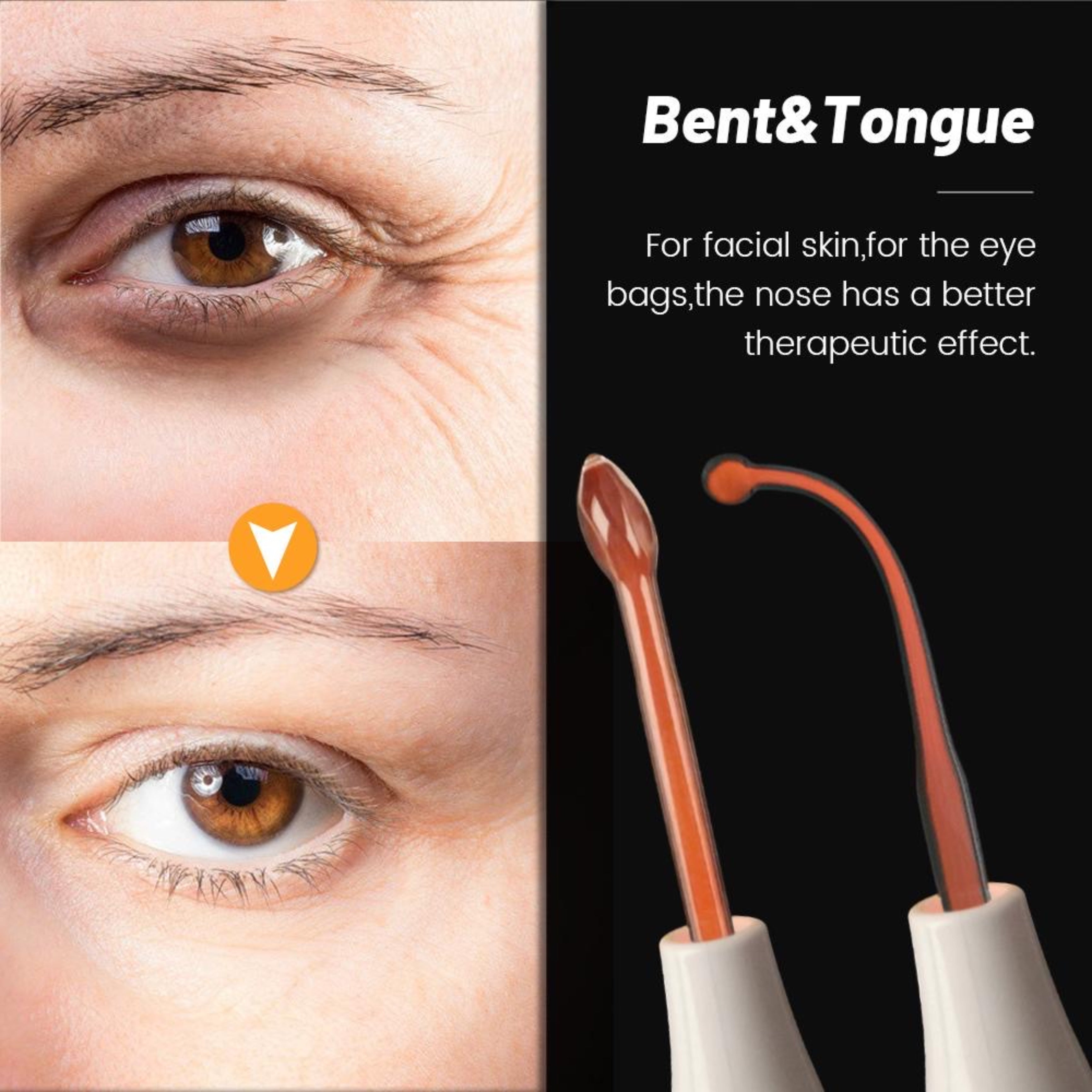 4-in-1 Hochfrequenzstab, Anti-Aging-Gerät, Mitesserentferner, Porenreiniger - Lalano’S Cosmetics 