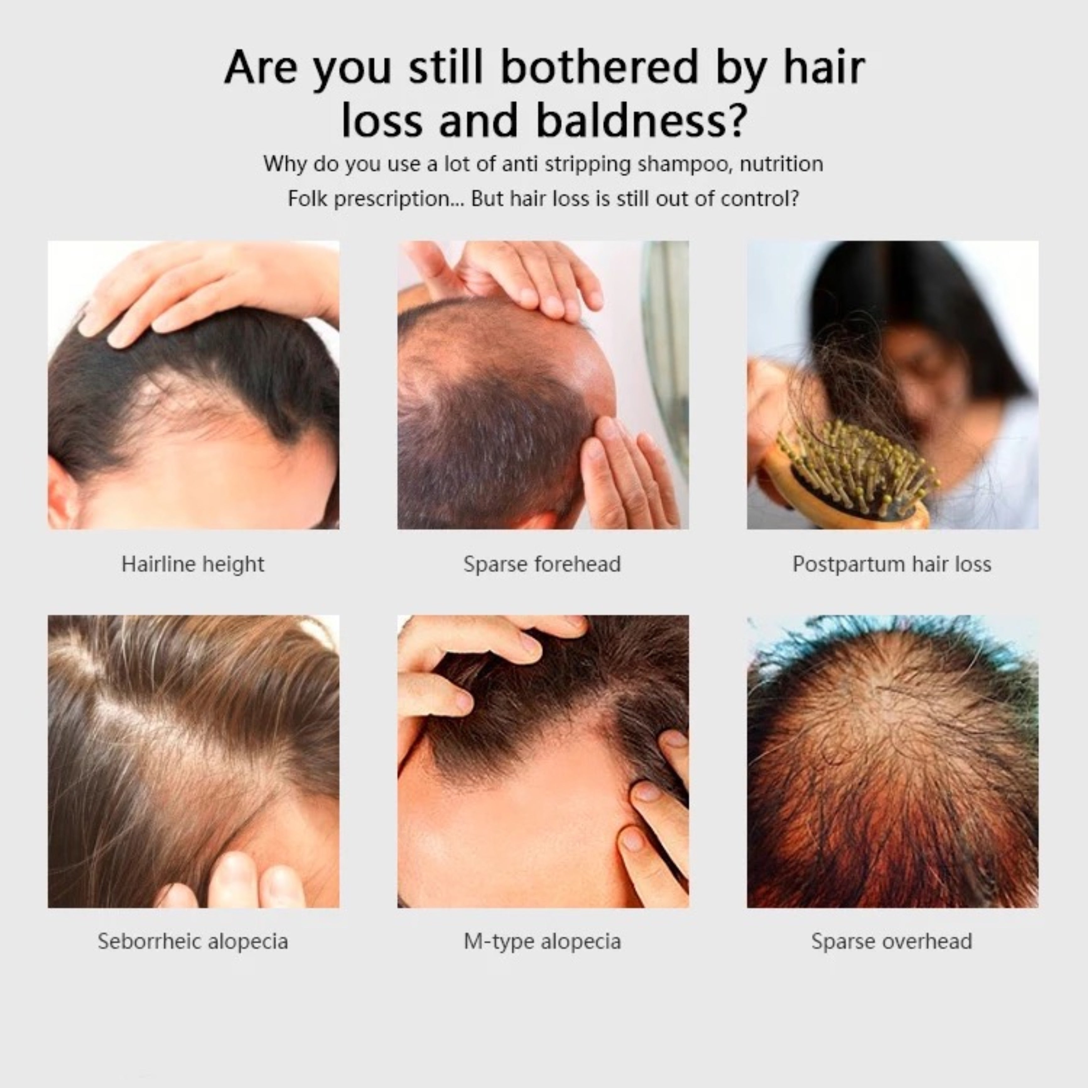 Hair PowerComb, Anti Haarausfall, LED Bürste, Haarwuchskamm - Lalano’S Cosmetics 