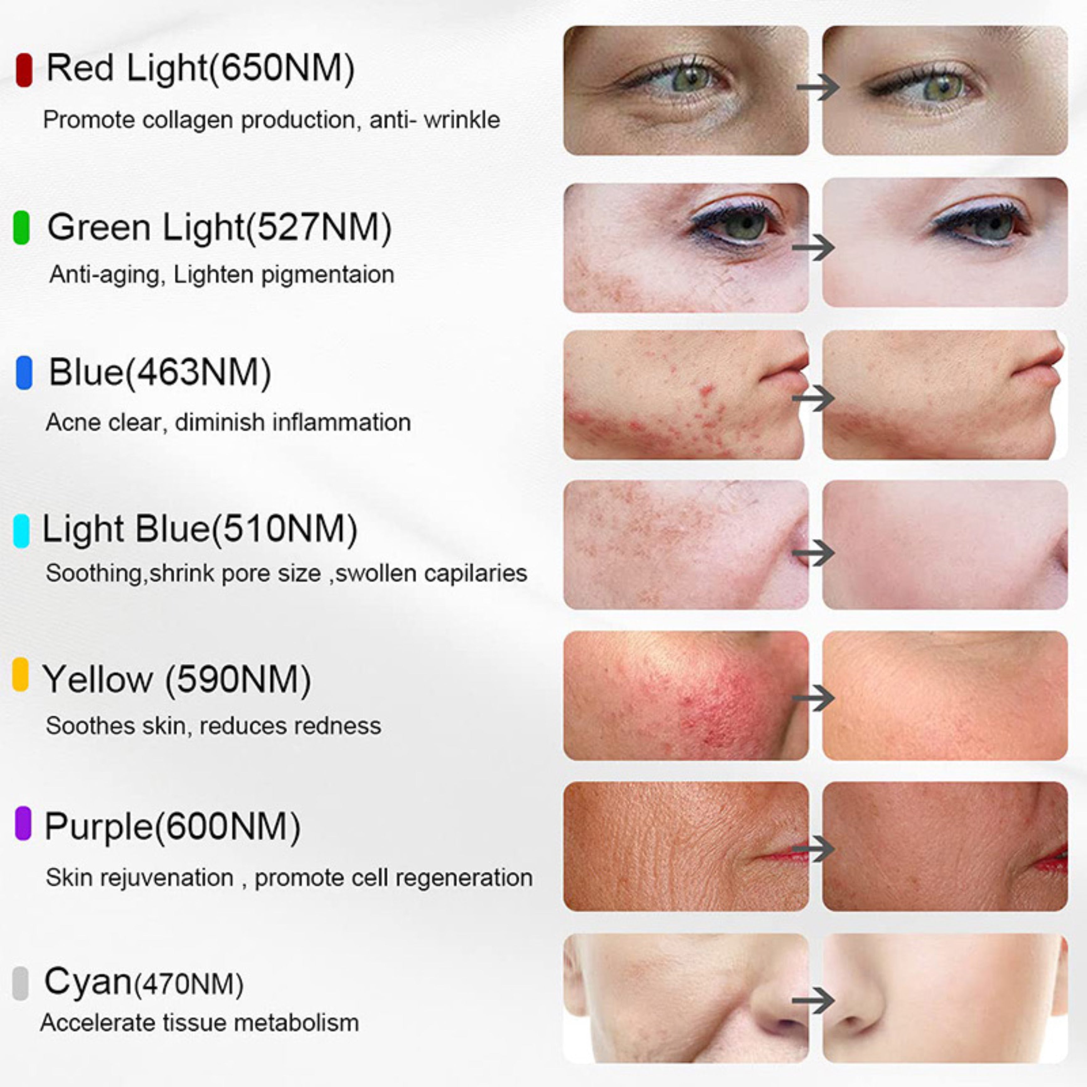 LED Gesichtsmaske, Anti-Aging-Gerät, Light facial BeautyMaske - Lalano’S Cosmetics 