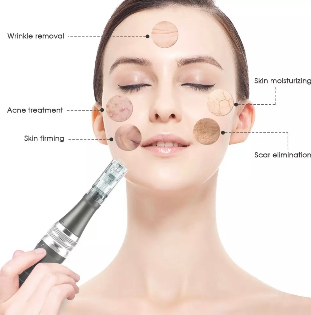 Micro-Needling Doktor Needle Pen, Anti-Aging-Gerät, Derma Pen, Porenreiniger - Lalano’S Cosmetics 