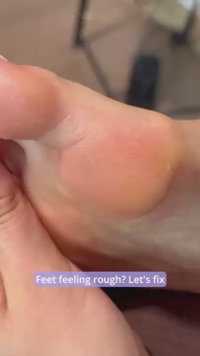 Lalanos Soft Feet Hornhautentferner - Produktvideo