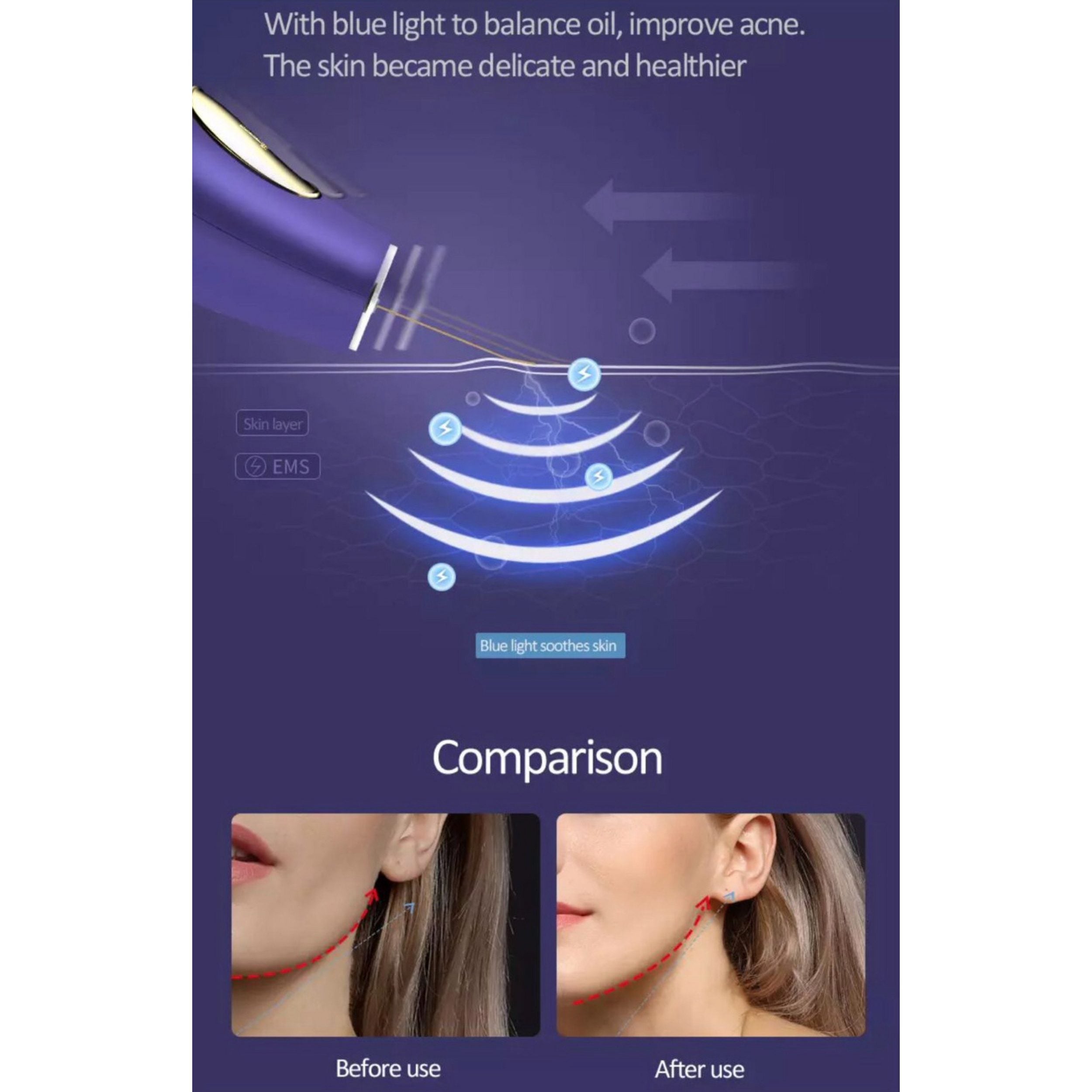 Glätteisen IPL Haartrockner Gesicht Mitesserentferner Warmluftbürste Lockenstab Pinzette Schwamm  Maniküre Pediküre Set Epilierer Anti Aging Elektrische Zahnbürste  Lalano’S Cosmetics Elite Lady Gesichtsreinigungsbürste Silikon Hornhautentferner Haarbürste